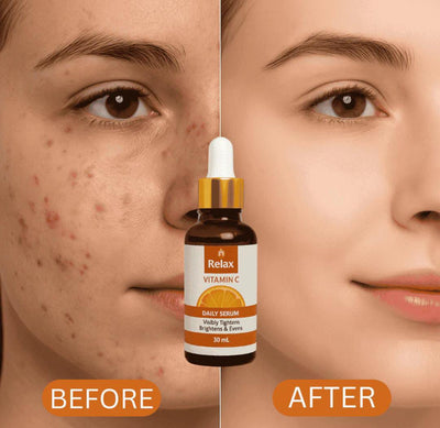 Relax Vitamin C Serum - Brightening & Anti-Aging Daily Glow (30mL)*