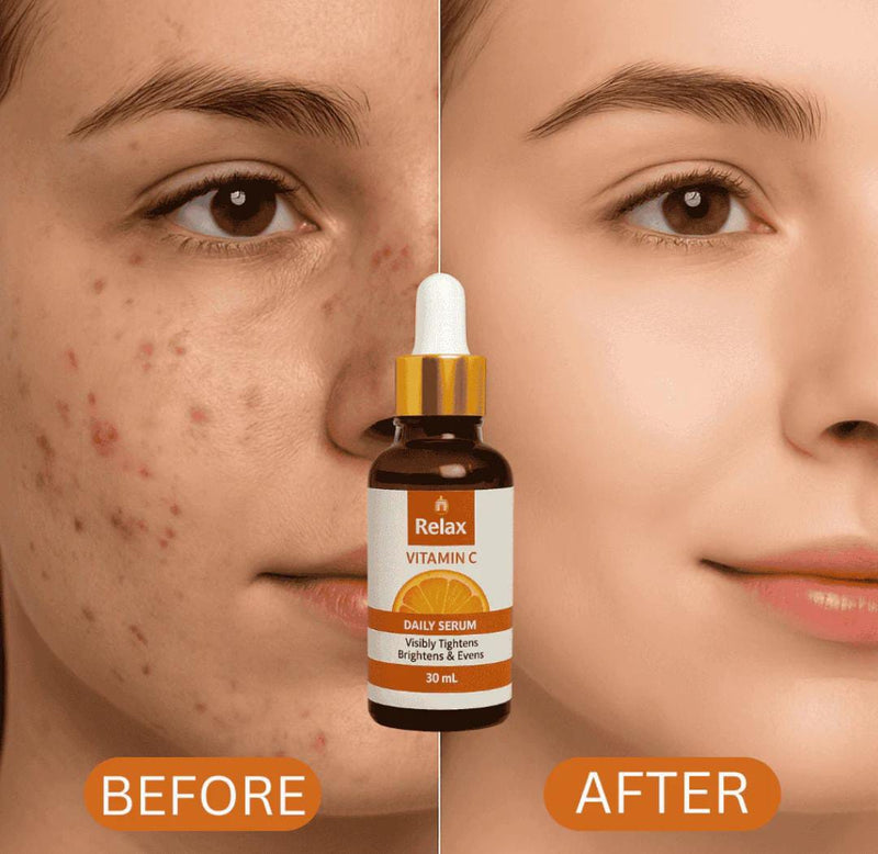 Relax Vitamin C Serum - Brightening & Anti-Aging Daily Glow (30mL)*
